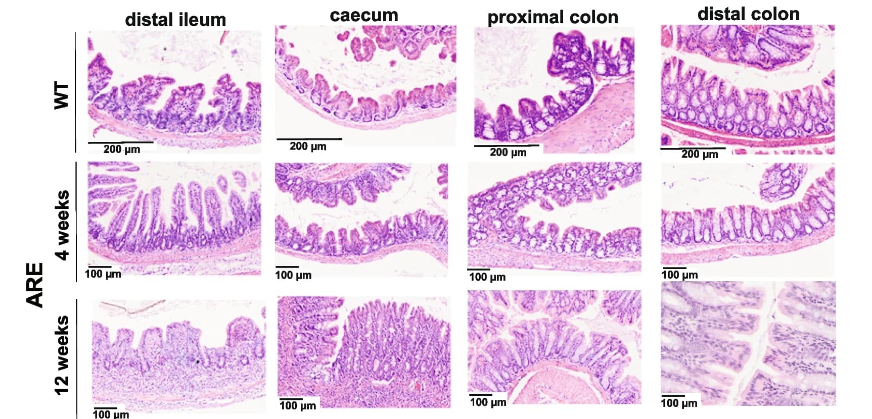 Open access visualization of Microscopy, H&E Staining, Tissue sections, Tnf ΔARE Mice, Intestinal inflammation