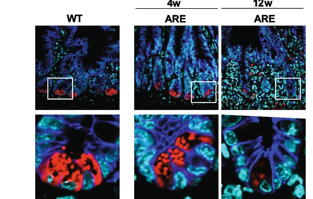 Open access visualization of Microscopy, Immunofluorescence, Lysozyme, E-cadherin, IEC borders