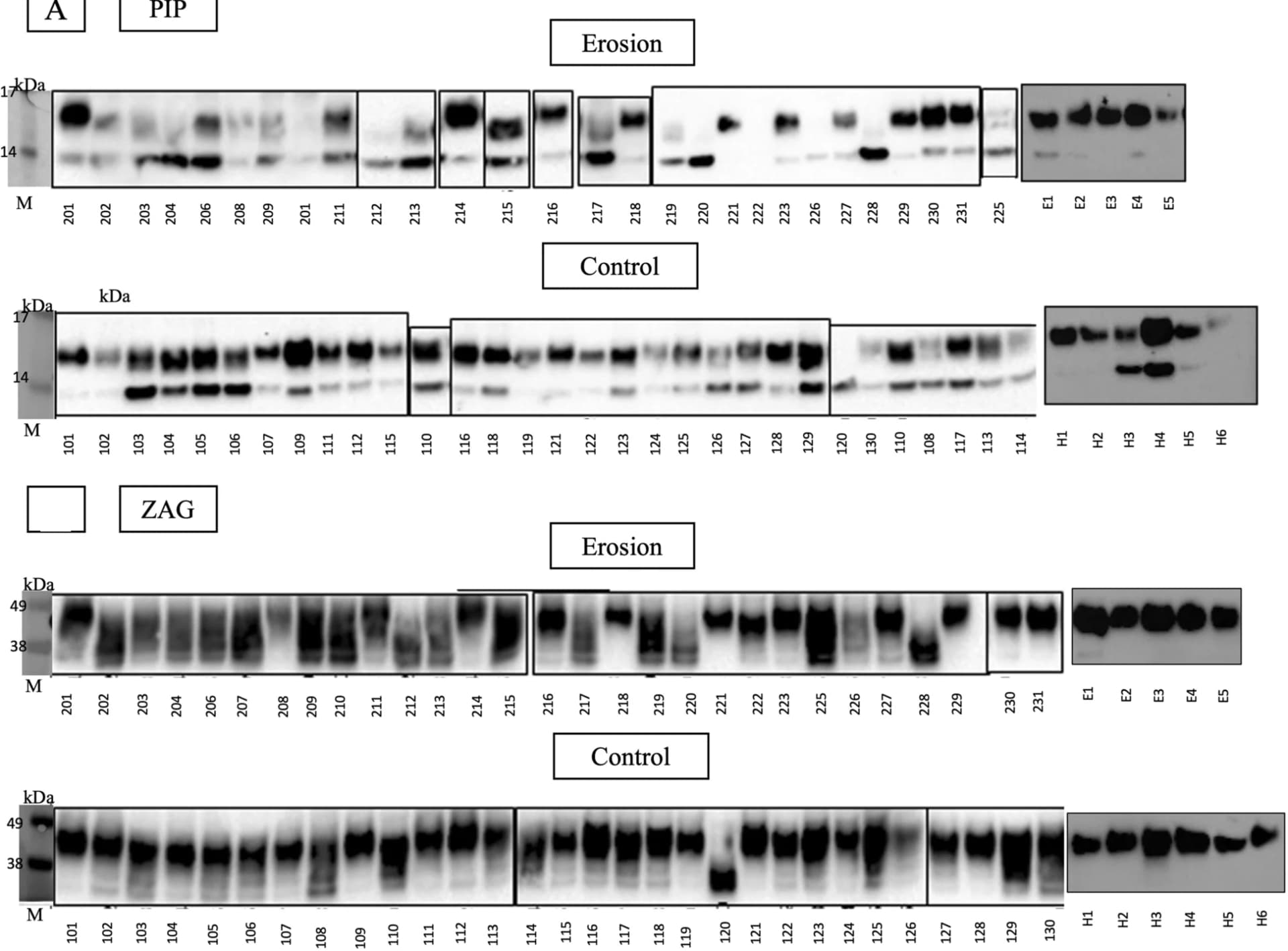 Open access visualization of Gel, ZAG Proteins, Saliva Samples, Erosion, Healthy Controls