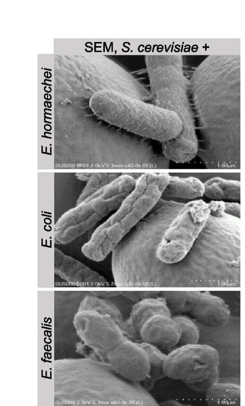 Open access visualization of Microscopy, Scanning Electron Microscopy, Mixed Cultures, Saccharomyces cerevisiae, Enterobacter hormaechei