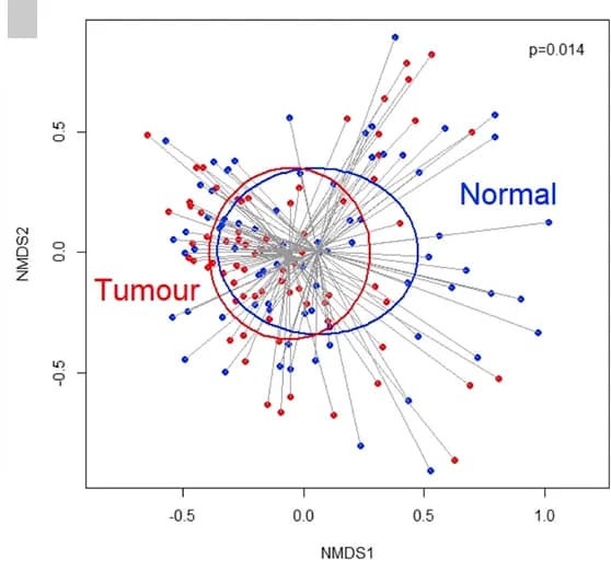 Open access visualization of Scatter Plot, Beta Diversity, NMDS, Weighted UniFrac Distances, Normal Mucosa