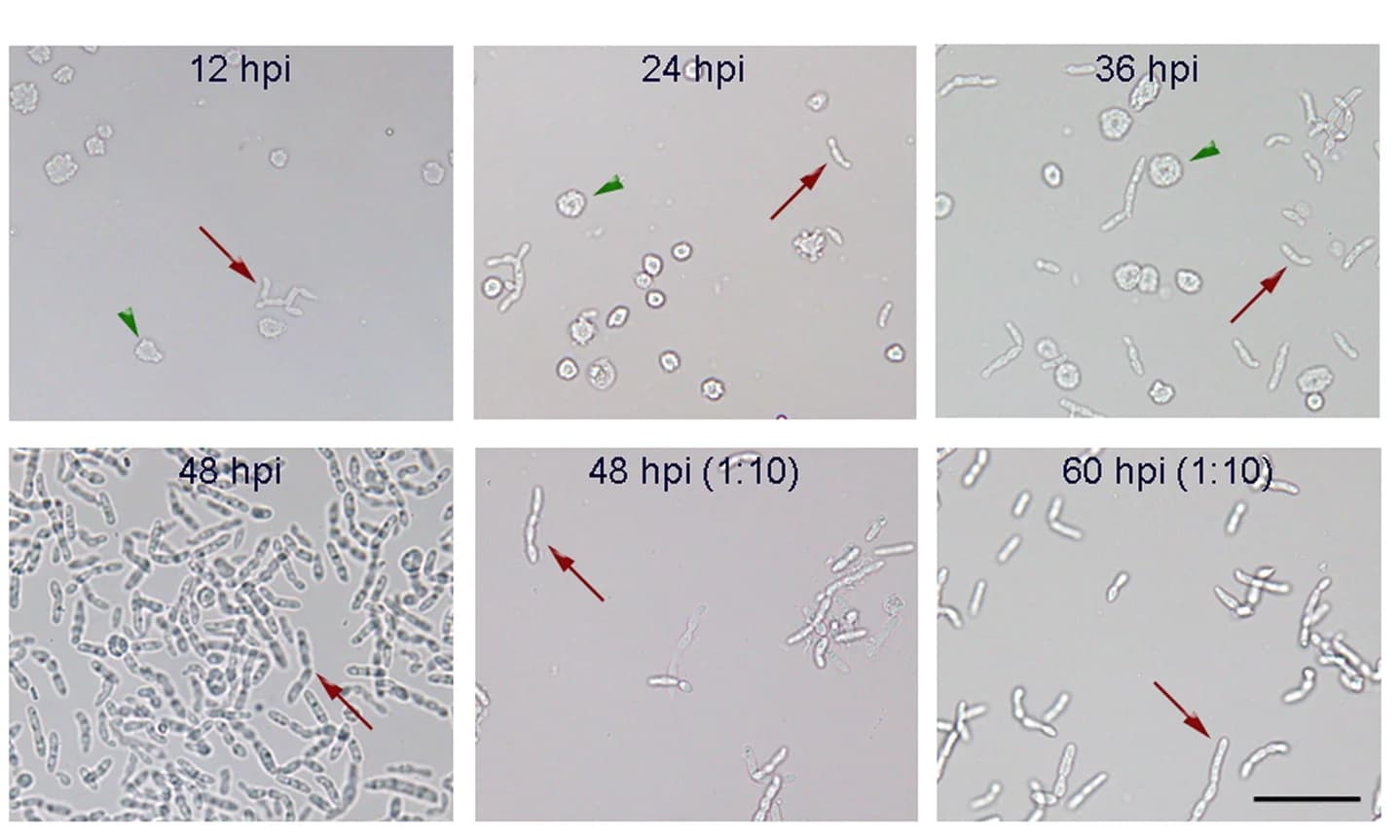 Open access visualization of Microscopy, Hyphal bodies, Hemolymph, H. armigera larvae, M. rileyi blastospores