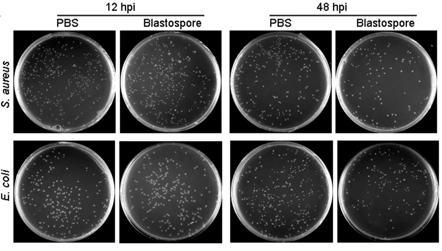Open access visualization of Photo, LB Agar Plates, S. Aureus, E. Coli, Plasma
