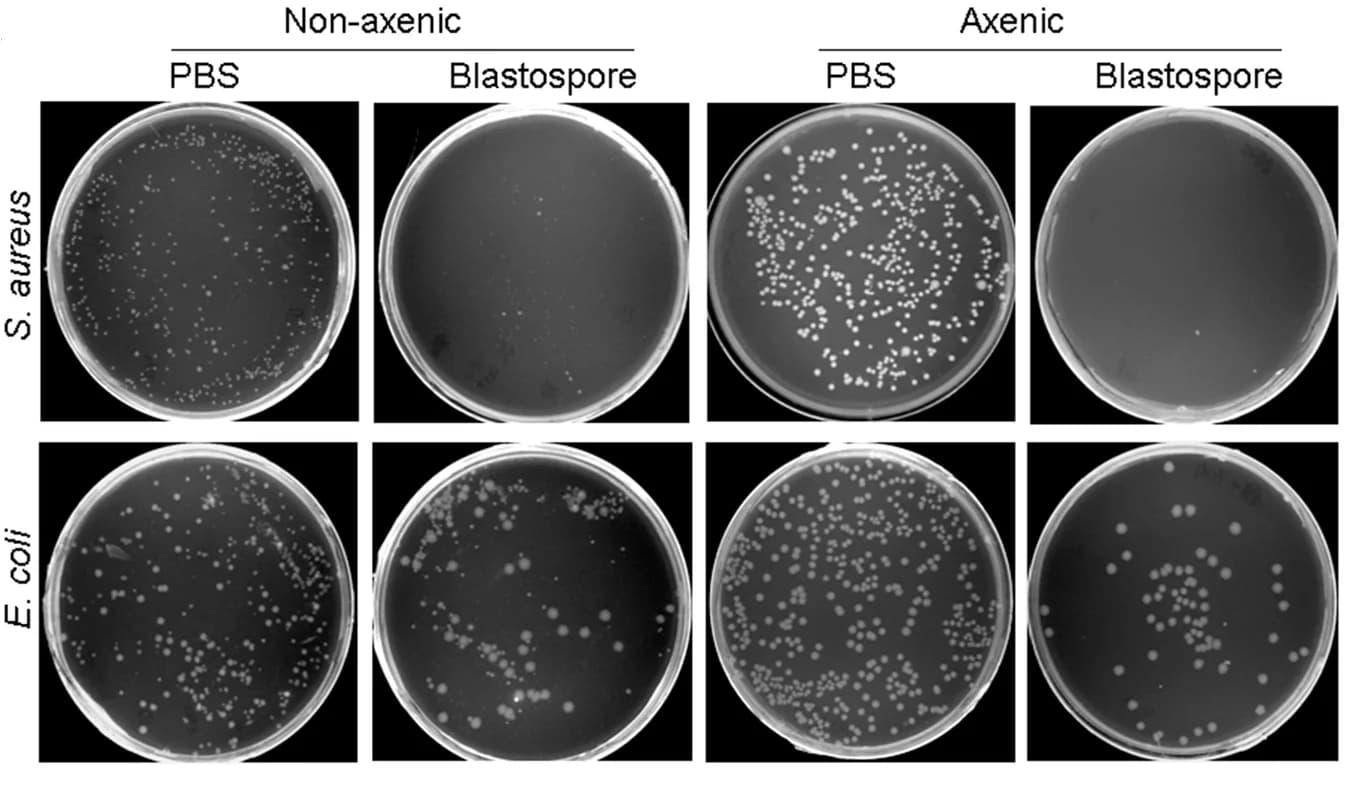 Open access visualization of Microscopy, Photo, LB Agar Plates, S. Aureus, E. Coli