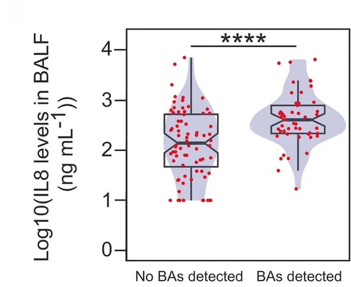 Open access visualization of Violin Plot, Box Plot, Scatter Plot, IL8
