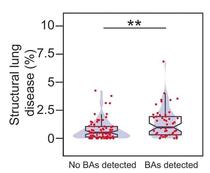 Open access visualization of Violin Plot, Box Plot, Scatter Plot, Lungs, Structural Disease