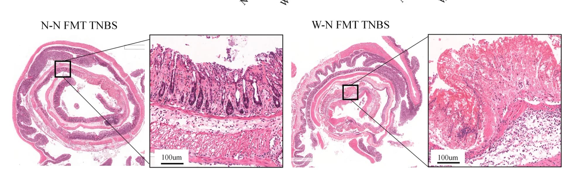 Open access visualization of Microscopy, Colon, H&E Staining, Histology