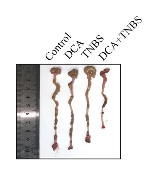 Open access visualization of Photo, Mouse Colon, DCA, TNBS, Representative Images