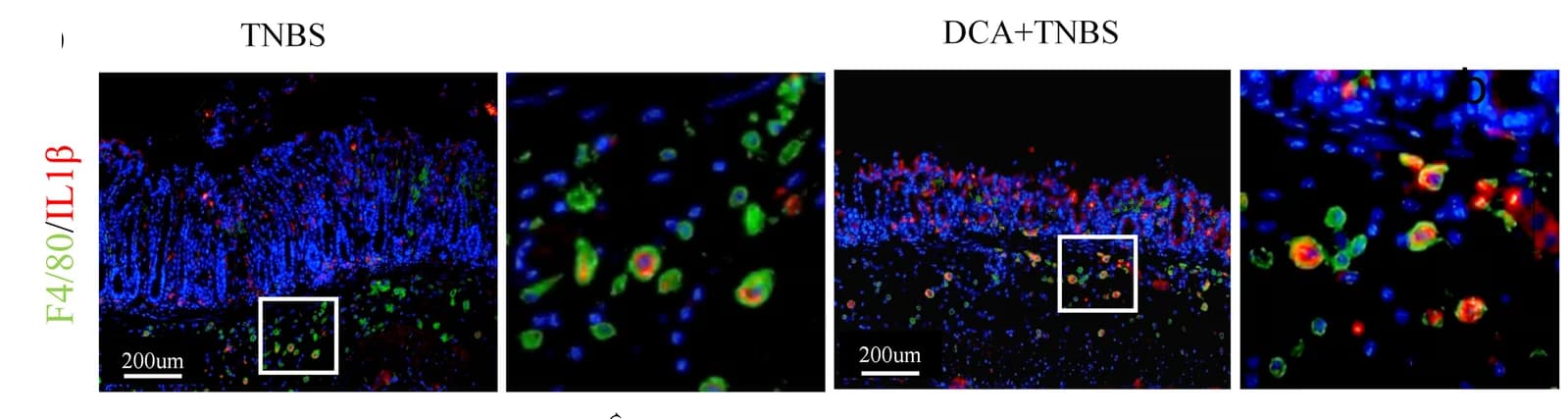 Open access visualization of Microscopy, Immunofluorescence, Colon Tissues, F4/80, IL-1β