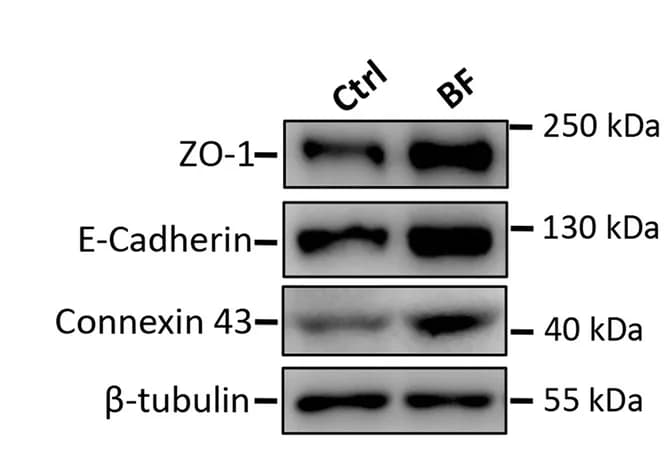 Open access visualization of Gel, Western blotting, ZO-1, E-cadherin, Connexin 43