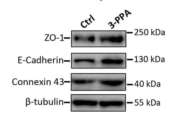 Open access visualization of Gel, Western blotting, ZO-1, E-cadherin, Connexin 43