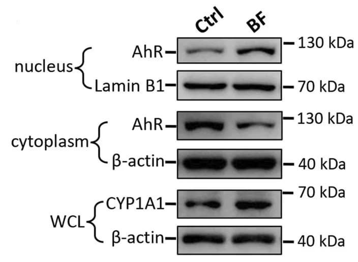 Open access visualization of Gel, Western Blotting, AhR, Lamin B1, beta-actin