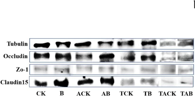 Open access visualization of Gel, Western Blots, Zo-1, Occludin, Claudin15