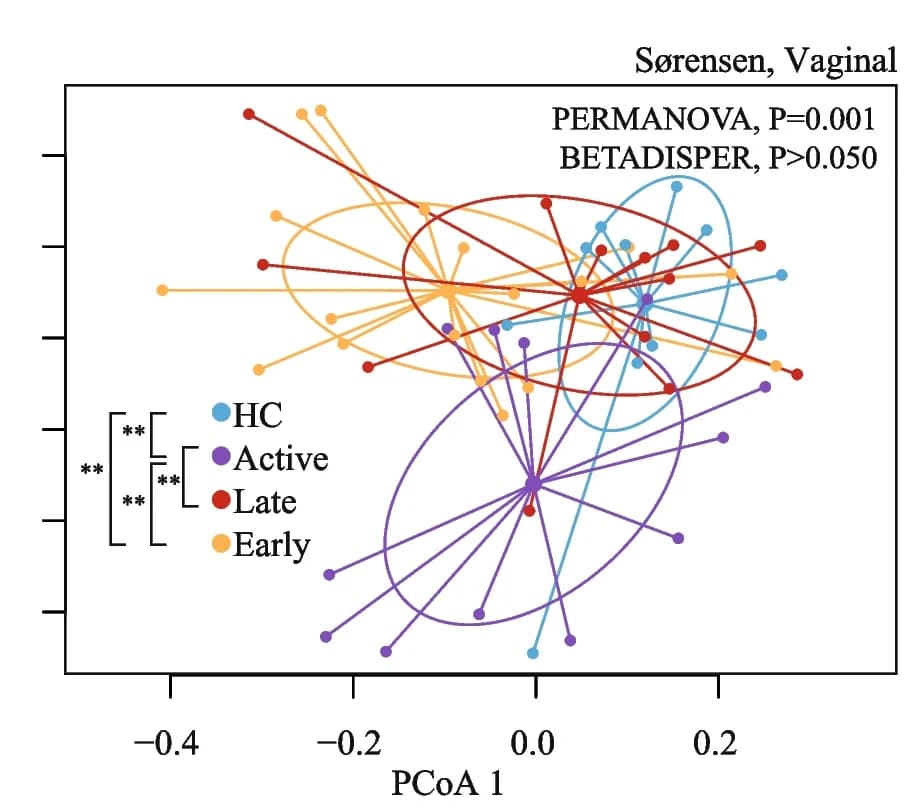 Open access visualization of Scatter Plot, PCA, Beta Diversity, Pregnant Women, SARS-CoV-2 Infection
