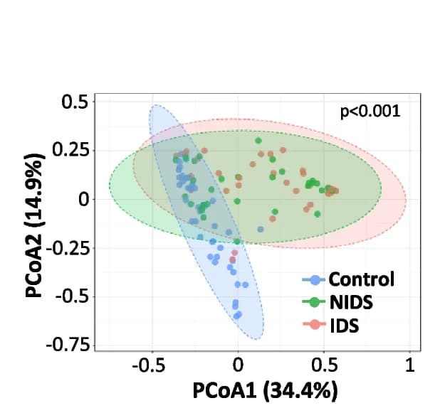 Open access visualization of Scatter Plot, PCA, Principal Coordinate Analysis, Beta-Diversity, Microbiota