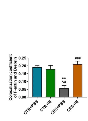 Open access visualization of Bar Plot, Error Bars, F-actin, Drebrin, PFCs