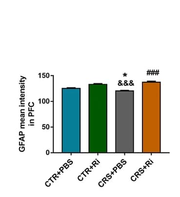 Open access visualization of Bar Plot, Error Bars, MFI, GFAP, statistical graph