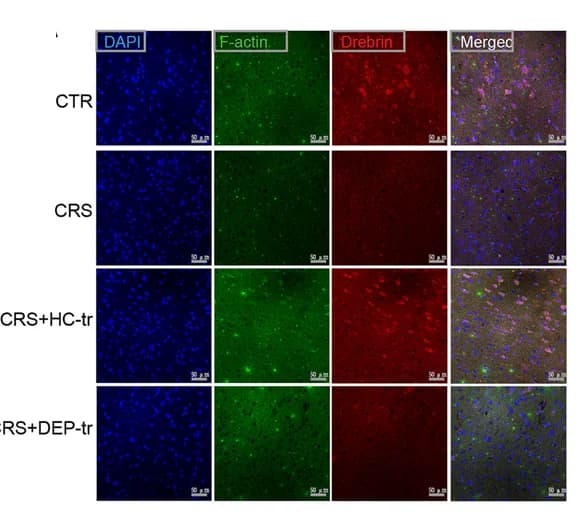 Open access visualization of Microscopy, F-actin, Drebrin, Colocalization, Coefficient analysis
