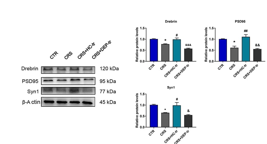 Open access visualization of Bar Plot, Error Bars, Gel, Photo, Drebrin