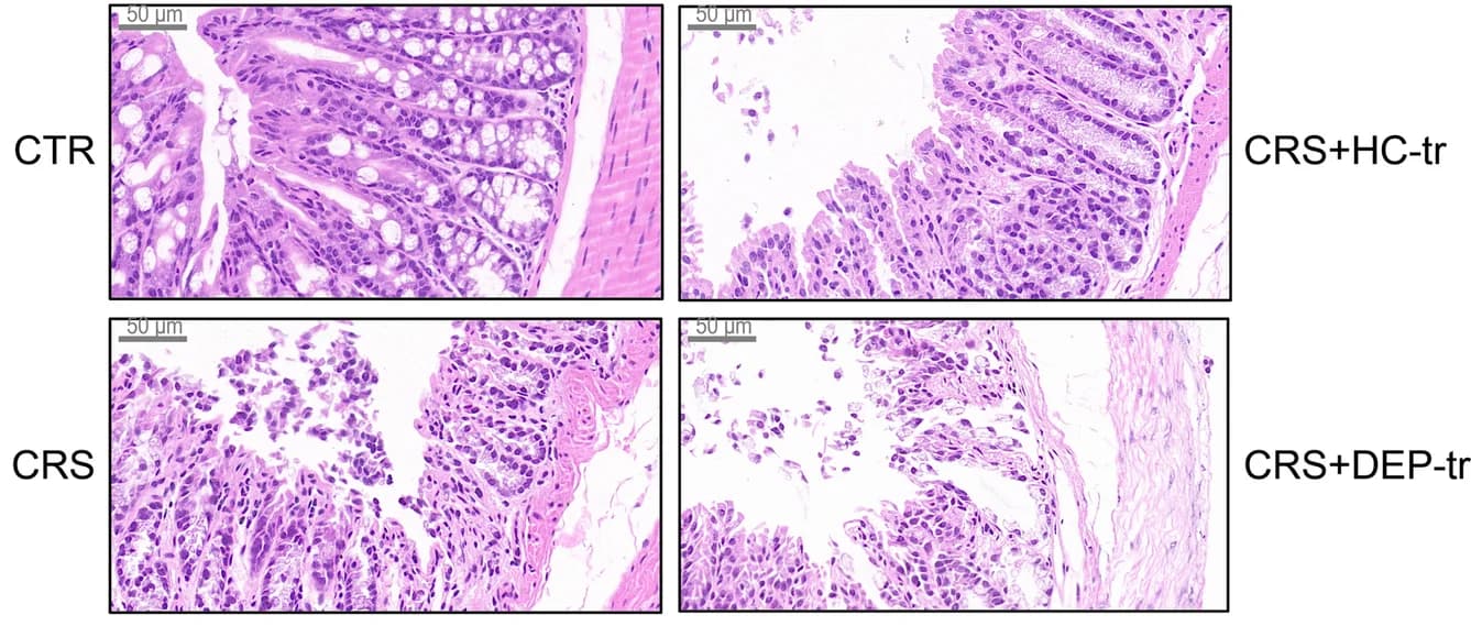 Open access visualization of Microscopy, H&E staining, Colon, Mice