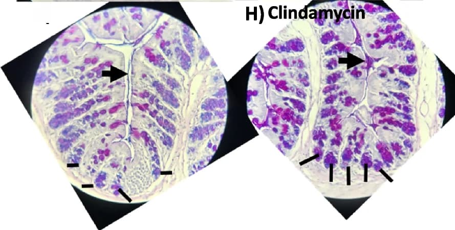 Open access visualization of Microscopy, Alcian Blue/PAS Staining, Neutral Mucins, Acidic Mucins, Mixed Mucins