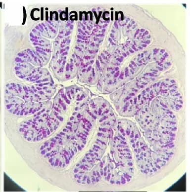 Open access visualization of Microscopy, Alcian Blue/PAS Staining, Neutral Mucins, Acidic Mucins, Mixed Mucins