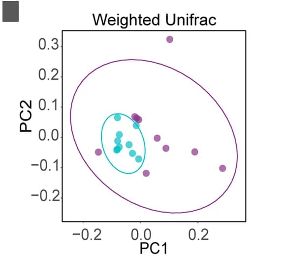 Open access visualization of Scatter Plot, PCA, Beta Diversity, Tick Microbiota, Weighted Unifrac Index