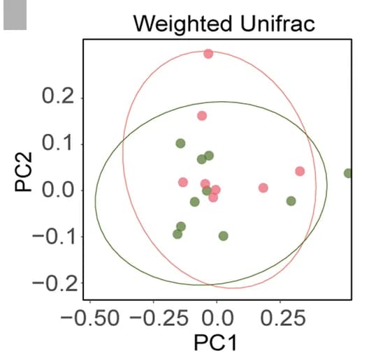 Open access visualization of Scatter Plot, PCA, Beta diversity, Tick microbiota, Weighted Unifrac index