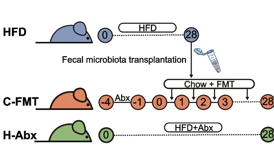 Open access visualization of Workflow, Flowchart, Illustration, Fecal Microbiota Transplantation, Antibiotic Cocktail
