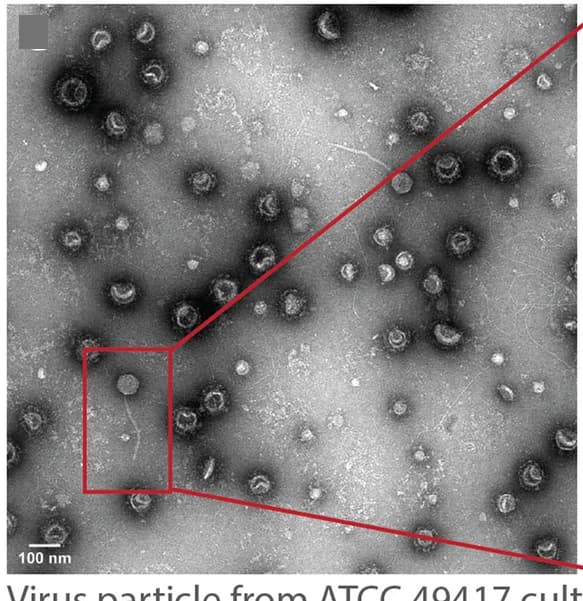 Open access visualization of Microscopy, Transmission Electron Micrograph, ATCC 49417, Cell Culture, Supernatant