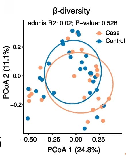 Open access visualization of Scatter Plot, PCA, PCoA, Gut Microbial Composition, Species Level