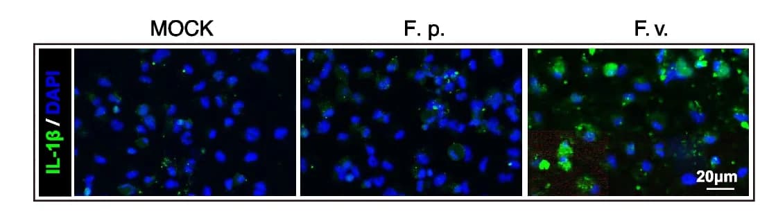 Open access visualization of Microscopy, Immunostaining, IL-1, Phalloidin, BMDM