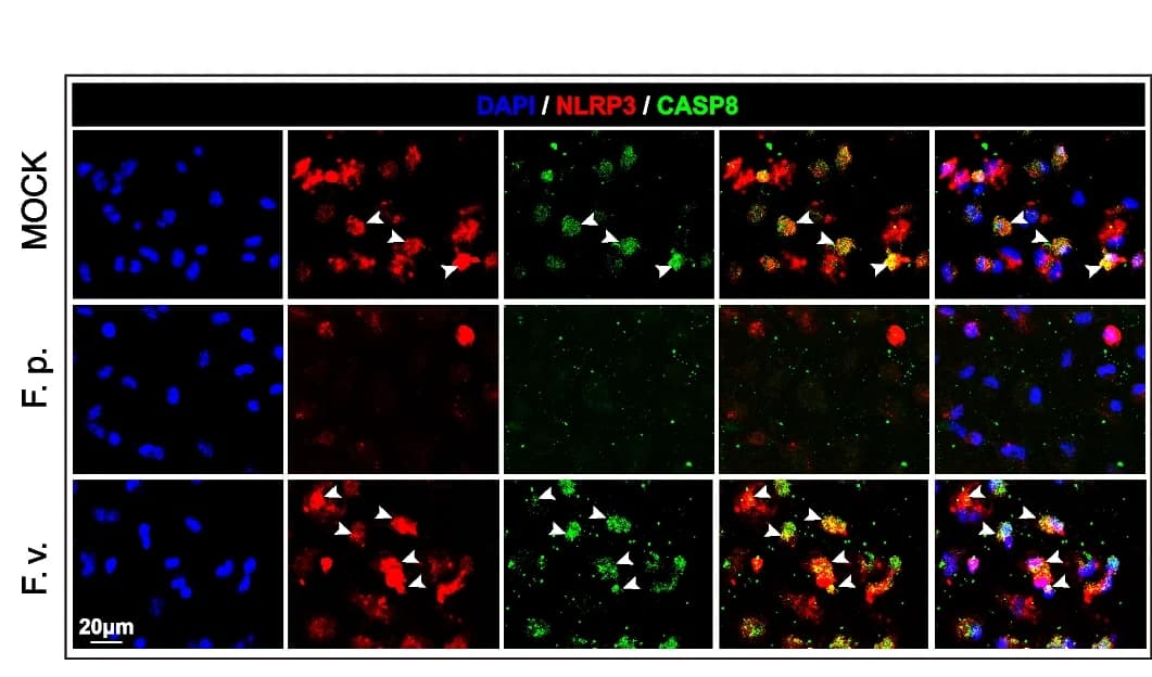 Open access visualization of Microscopy, Immunostaining, NLRP3, Caspase-8, Inflammasomes