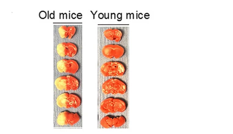 Open access visualization of Photo, Brain Slice