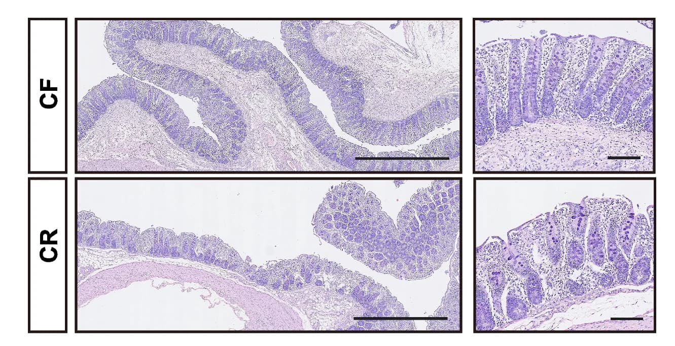 Open access visualization of Microscopy, H&E Staining, Colonic Sections
