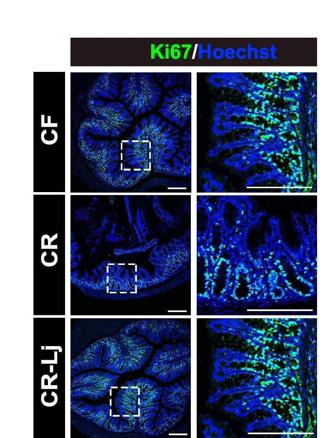 Open access visualization of Microscopy, Immunofluorescence, Colonic Sections, Ki67, Hoechst