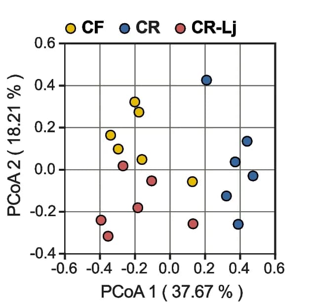 Open access visualization of Scatter Plot, PCA, PCoA, Colonic Microbiome, UniFrac Distance