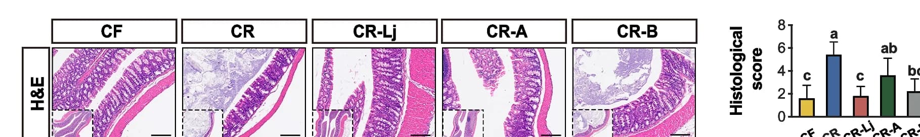 Open access visualization of Microscopy, Bar Plot, Error Bars, Colon, H&E Staining