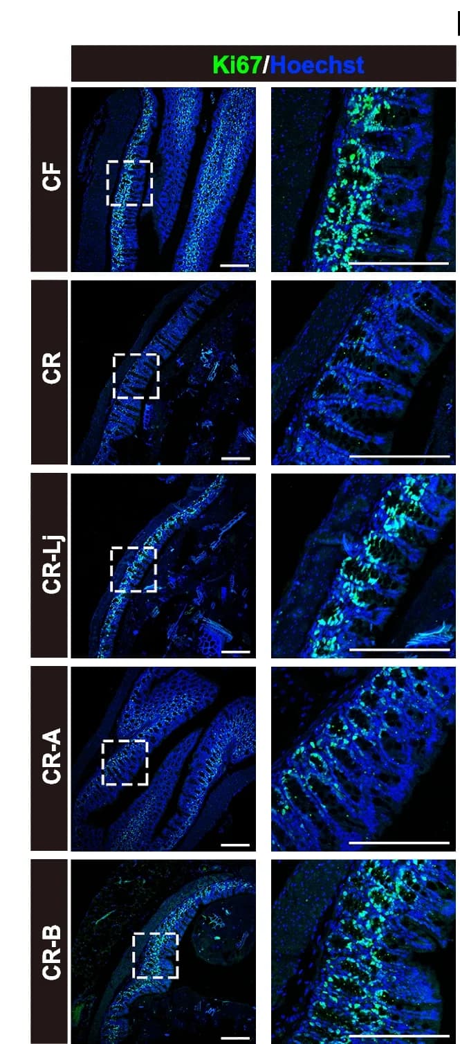Open access visualization of Microscopy, Immunofluorescence, Colon Sections, Ki67, Hoechst