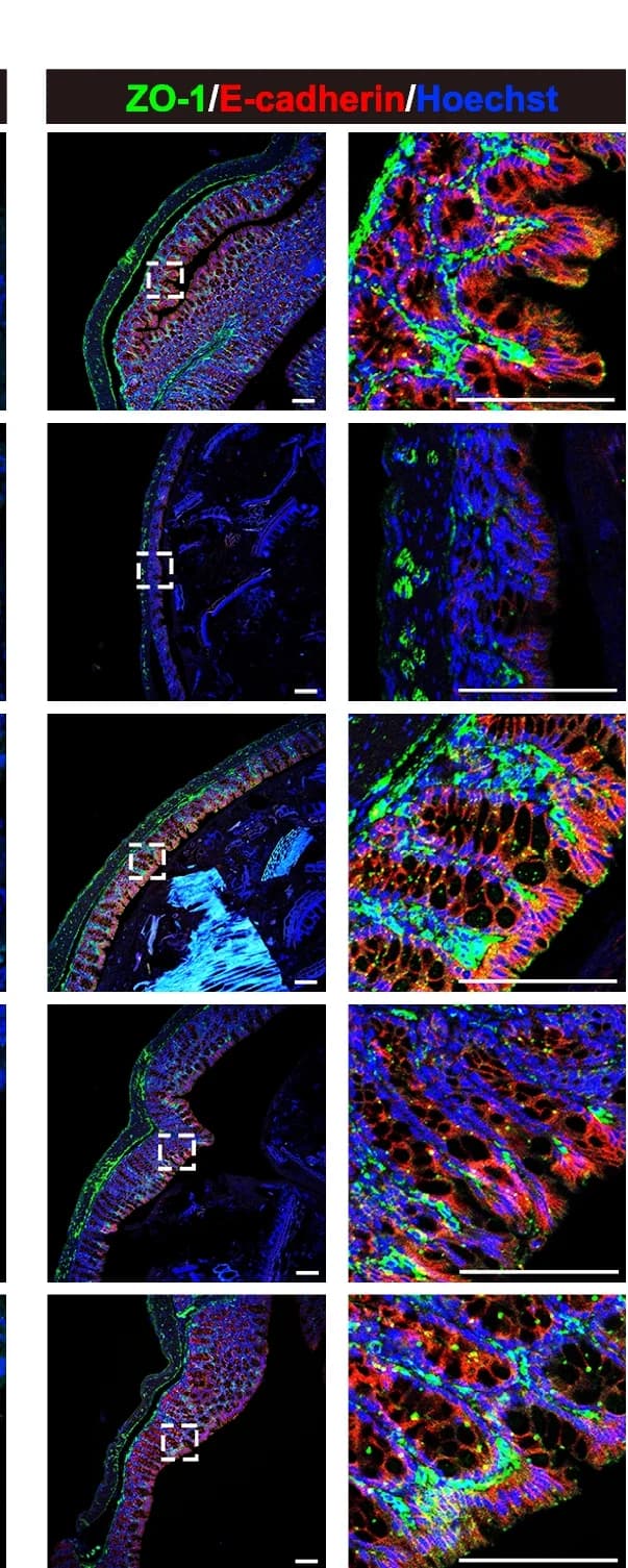 Open access visualization of Microscopy, Immunofluorescence, Colon Sections, ZO-1, E-cadherin