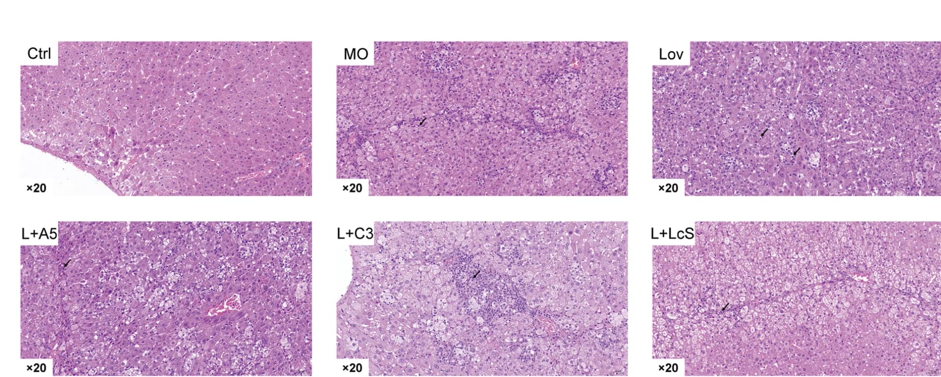 Open access visualization of Microscopy, Histological Sections, H&E Staining, Liver Tissue
