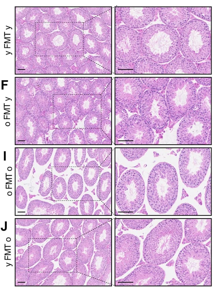 Open access visualization of Microscopy, H&E staining, Testis tissues, FMT Mice