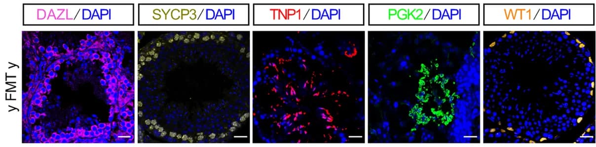 Open access visualization of Microscopy, Immunofluorescence Staining, Testis Tissues, FMT Mice, DAZL