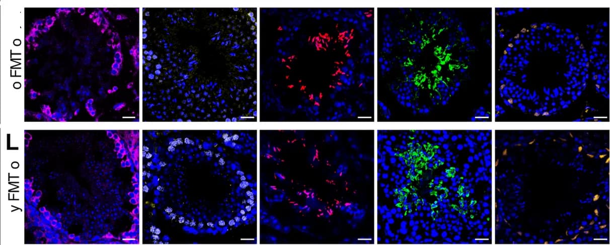 Open access visualization of Microscopy, Immunofluorescence Staining, Testis Tissues, FMT Mice, DAZL