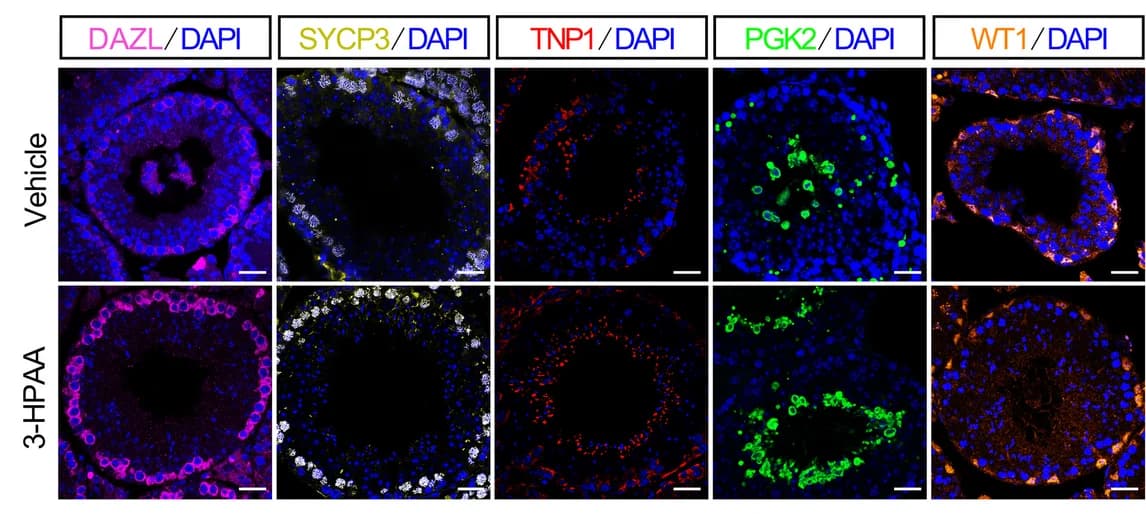 Open access visualization of Microscopy, Immunofluorescence staining, DAZL, Spermatogonia marker, SYCP3