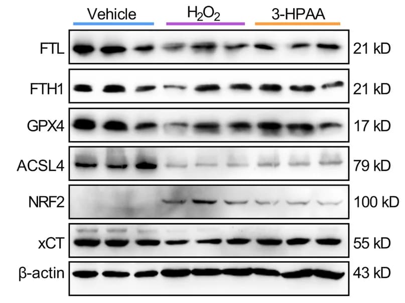 Open access visualization of Gel, Protein Expression, FTL, FTH1, GPX4