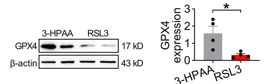 Open access visualization of Bar Plot, Error Bars, Gel, Photo, Western Blot Analysis