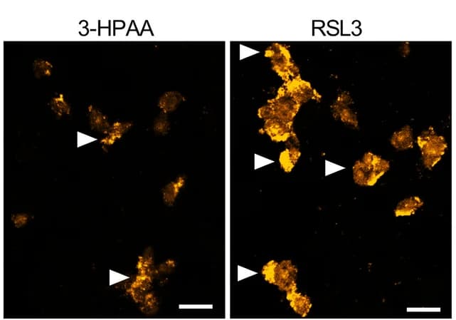 Open access visualization of Microscopy, Iron Staining, GC-2 Cells, RSL3, Fe 2+