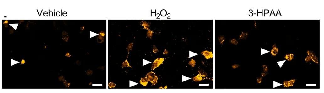 Open access visualization of Microscopy, Western Blot Analysis, GPX4, GC-2 Cells, Gpx4 siRNA