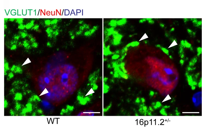 Open access visualization of Microscopy, Confocal Planes, VGLUT1, Perisomatic Puncta, Neurons